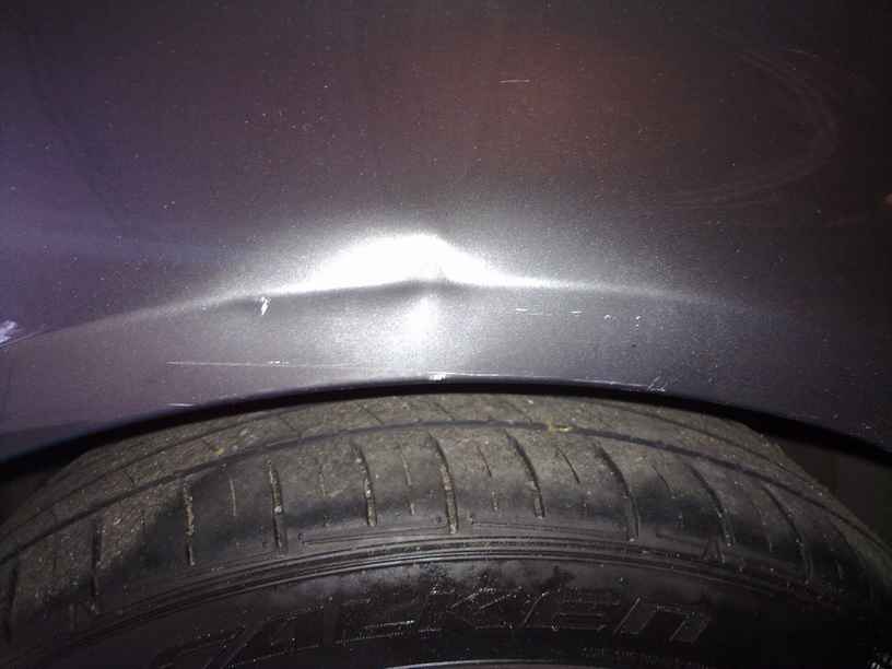 dent.jpg